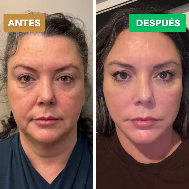 Cepillo Contorno Facial Linfatico Seolhwa